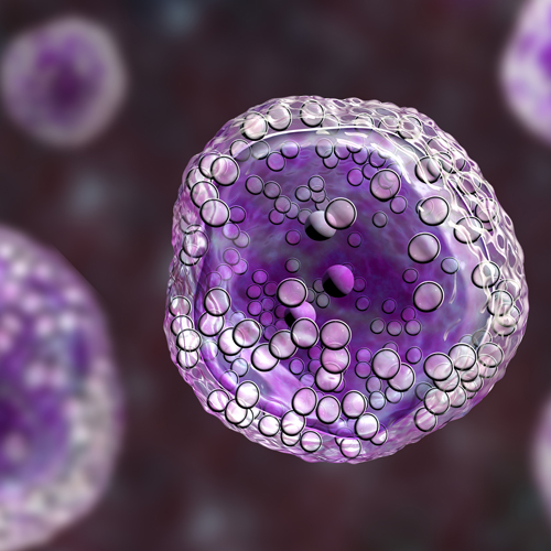 Lymphoma